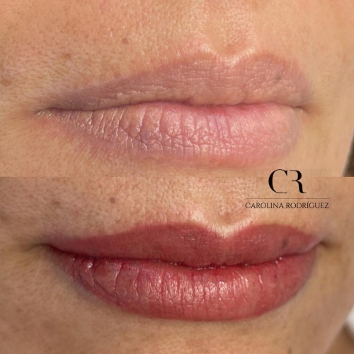 Acuarela Lips