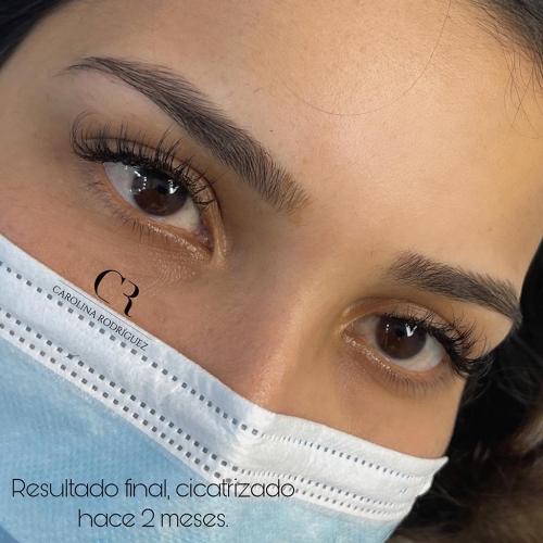 Microblading