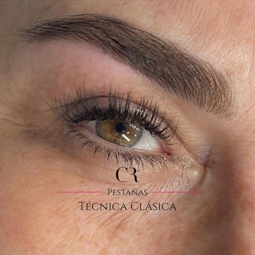 Extensiones Técnica Clásica
