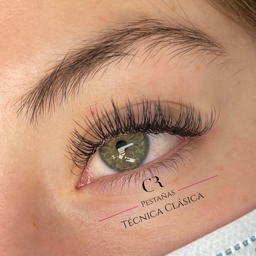Extensiones Técnica Clásica