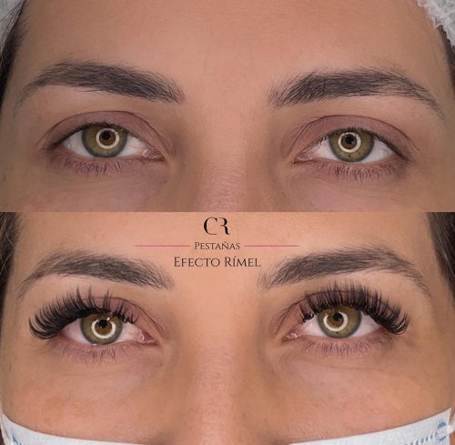 Extensiones Efecto Rimel