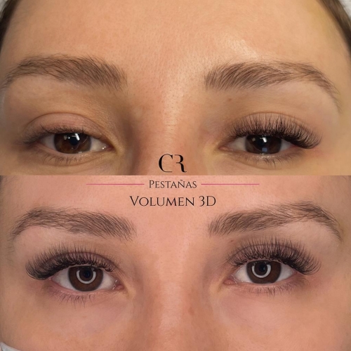 Extensiones Volumen 3D
